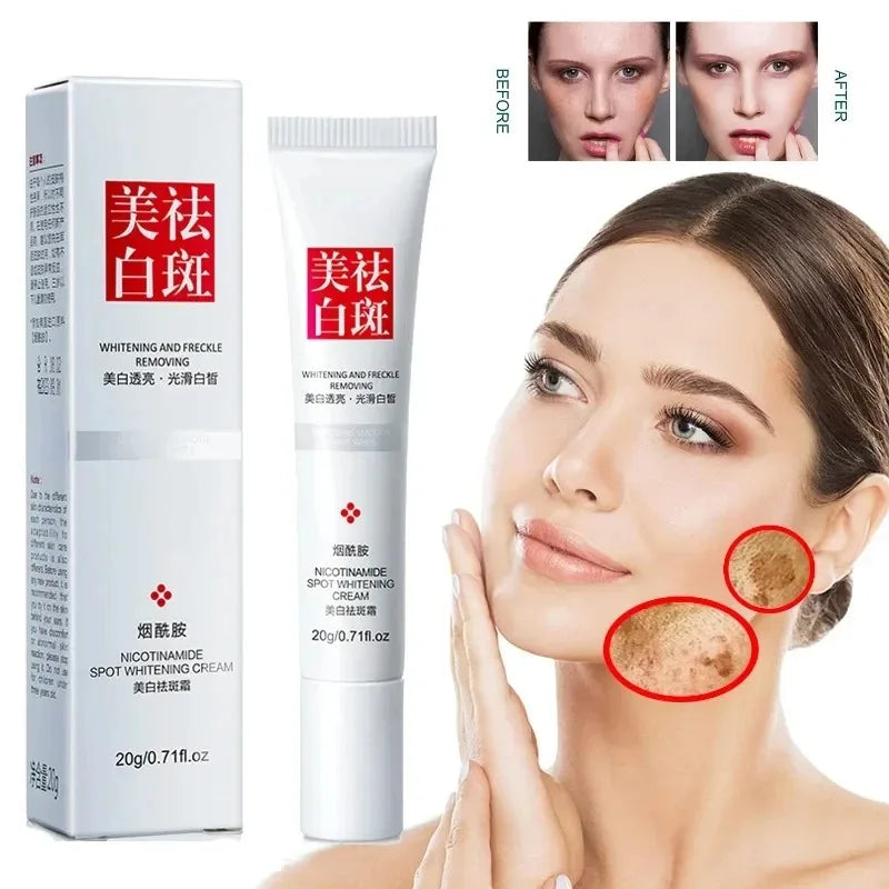 Niacinamide Whitening Face Cream for Dull Skin Fast Brightening Effect with Vitamin E and Fades Freckle Dark Spots